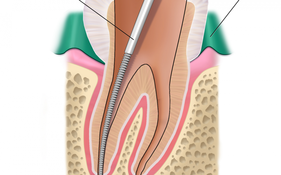 ENDODONZIA